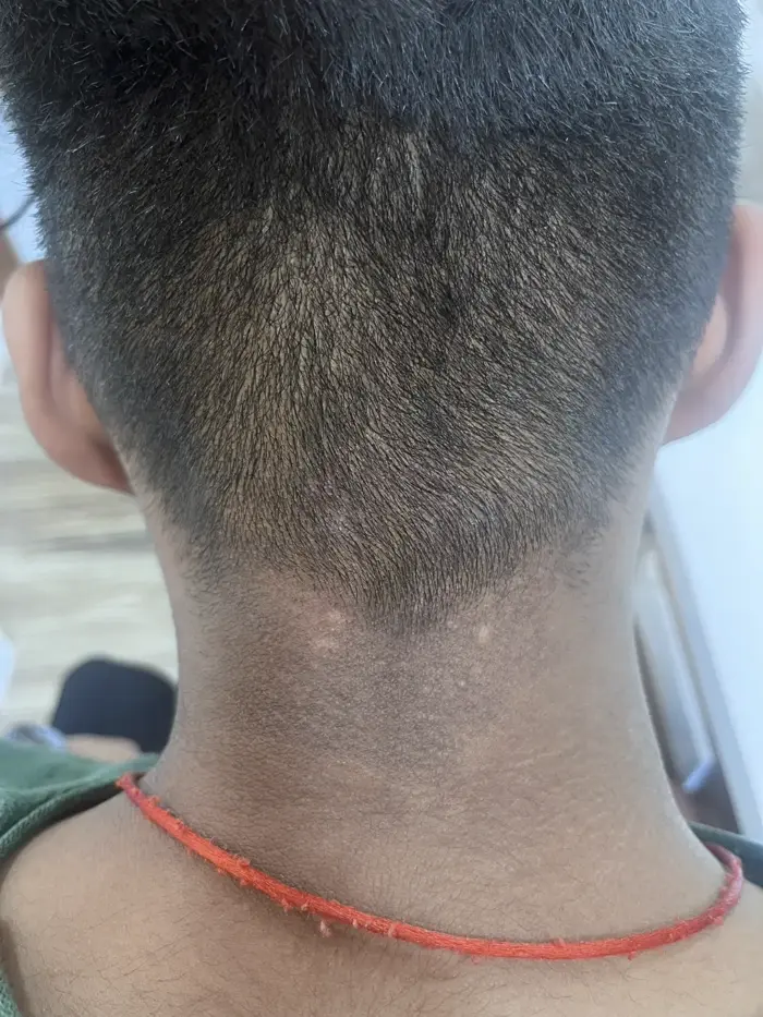 Other condition case 1 after treatment
