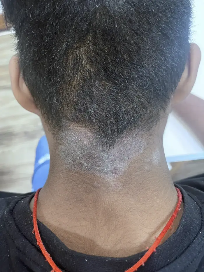 Other condition case 1 before treatment