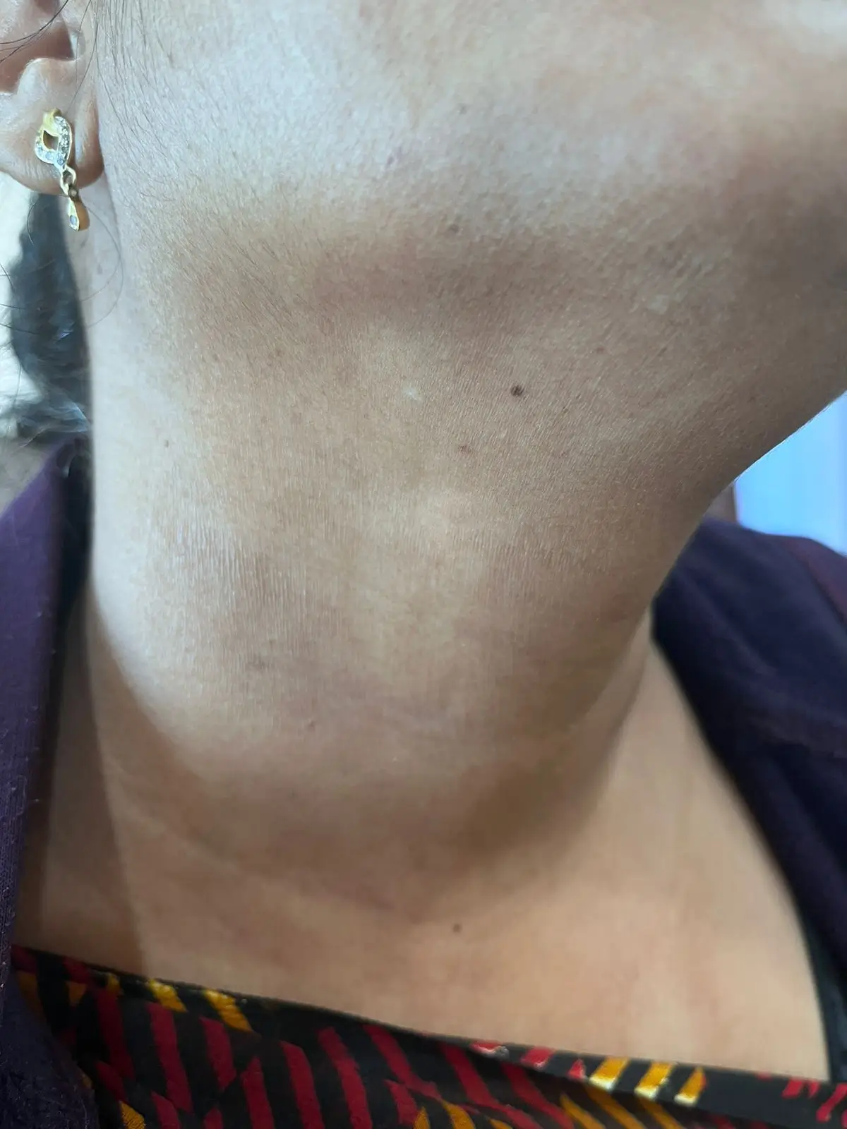 Other condition case 2 after treatment