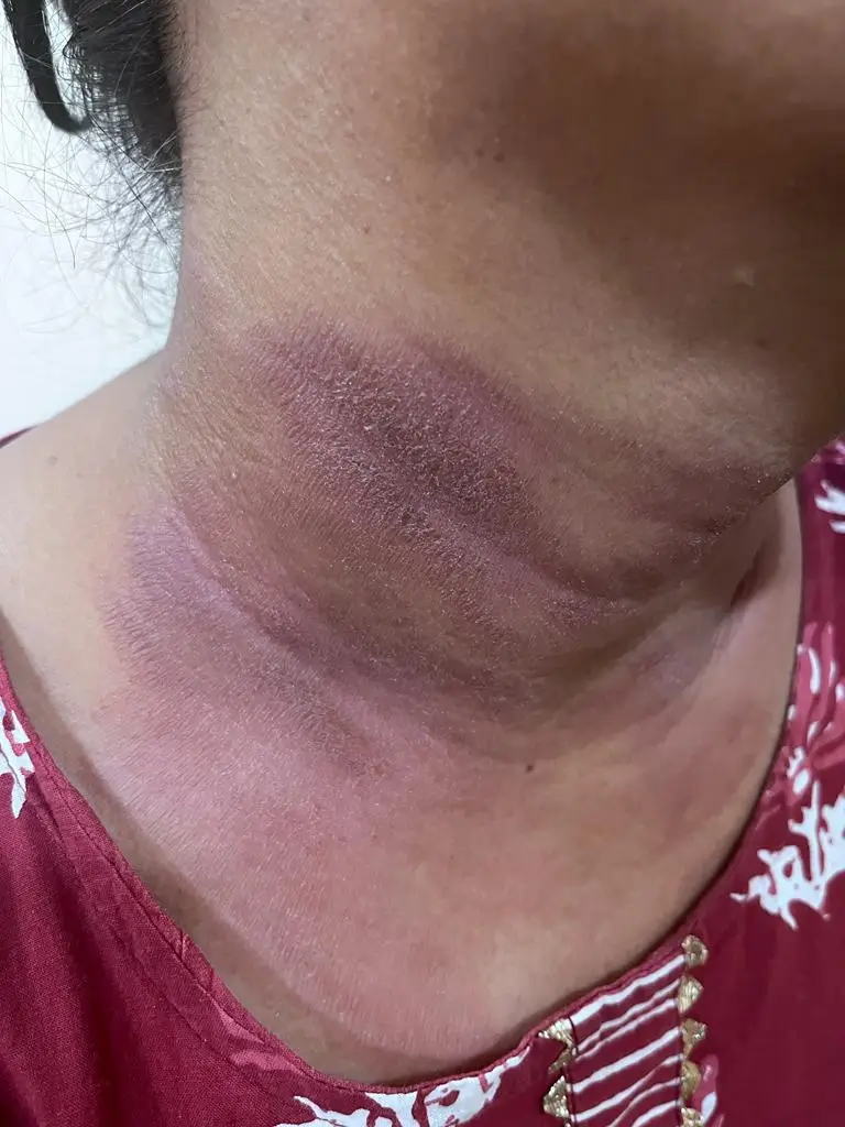 Other condition case 2 before treatment