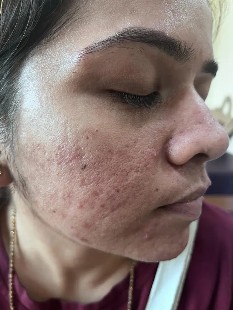 Other condition case 3 after treatment