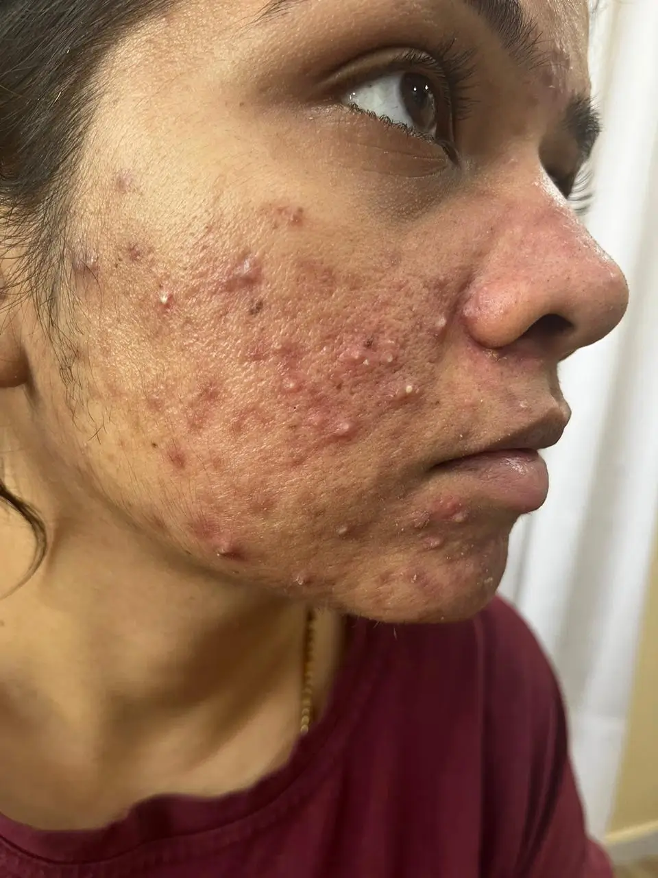 Other condition case 3 before treatment