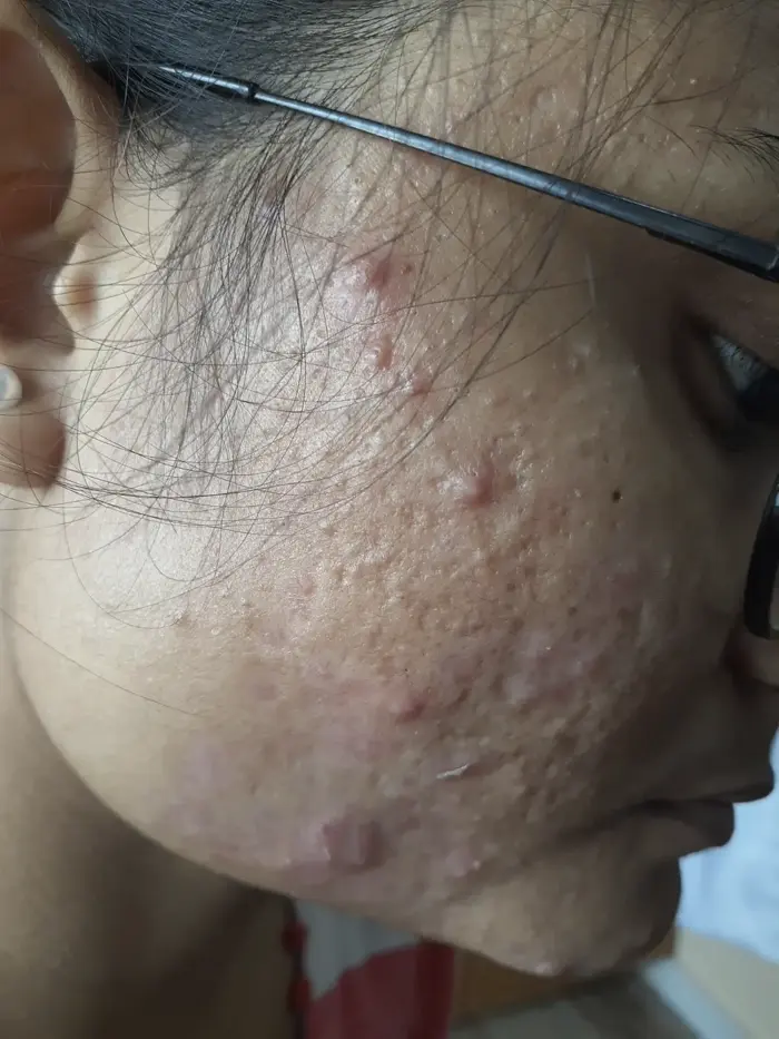 Other condition case 4 before treatment